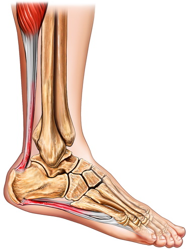 Rozcięgno podeszwowe łączy się przez kość piętową ze ścięgnem Achillesa